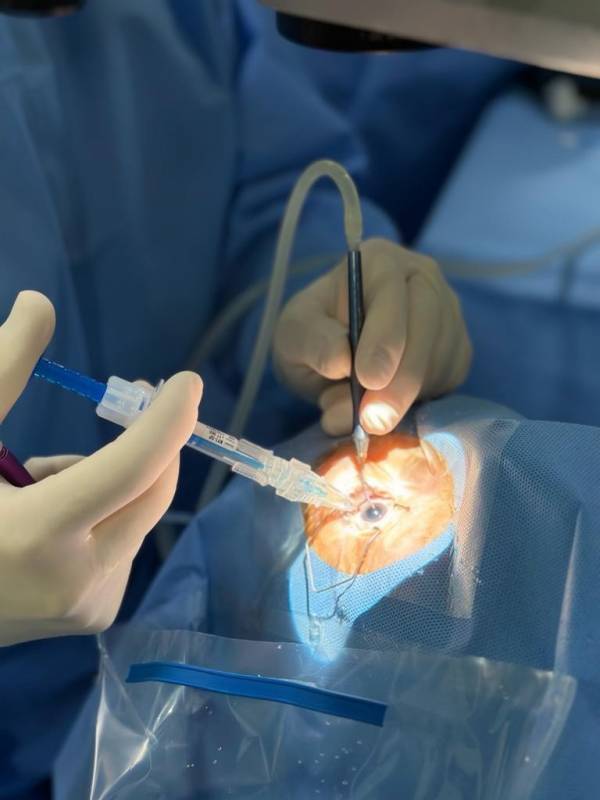 Cirurgia Facoemulsificação com Lio Poá - Facoemulsificação com Implante de Lente