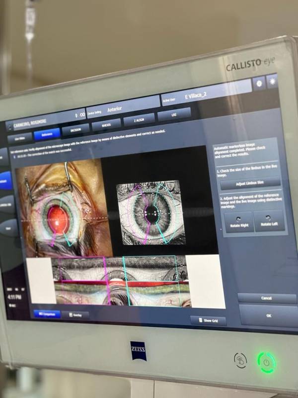 Telefone de Médico Especialista em Cirurgia de Catarata com Implante Freguesia do Ó - Médico Especialista de Olhos São Paulo