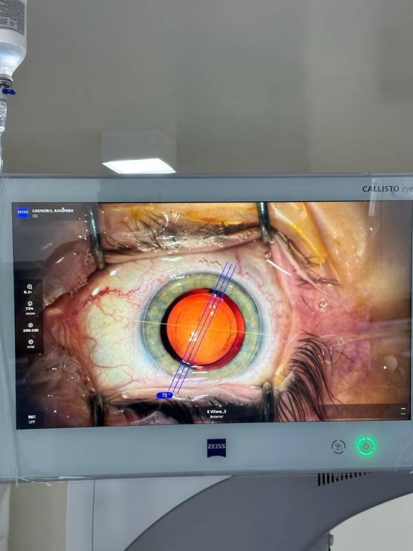 Telefone de Médico Especialista em Cirurgias de Catarata a Laser Vila Andrade - Médico Especialista em Facectomia