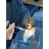 cirurgia catarata laser Vila Prudente