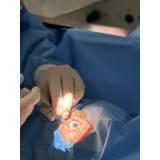 cirurgia de catarata laser agendar Itaquaquecetuba