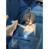 clínica que faz cirurgia a laser de catarata ultramarino